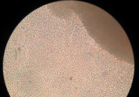 3-20160107_160931_Sperma.jpg (186.24 KiB) 40761-mal betrachtet 3-20160107_160931_Sperma.jpg