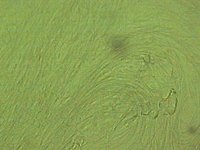 5-P. dives Gyne 3-09 Sperma x 40 web.jpg (37.28 KiB) 40761-mal betrachtet 5-P. dives Gyne 3-09 Sperma x 40 web.jpg